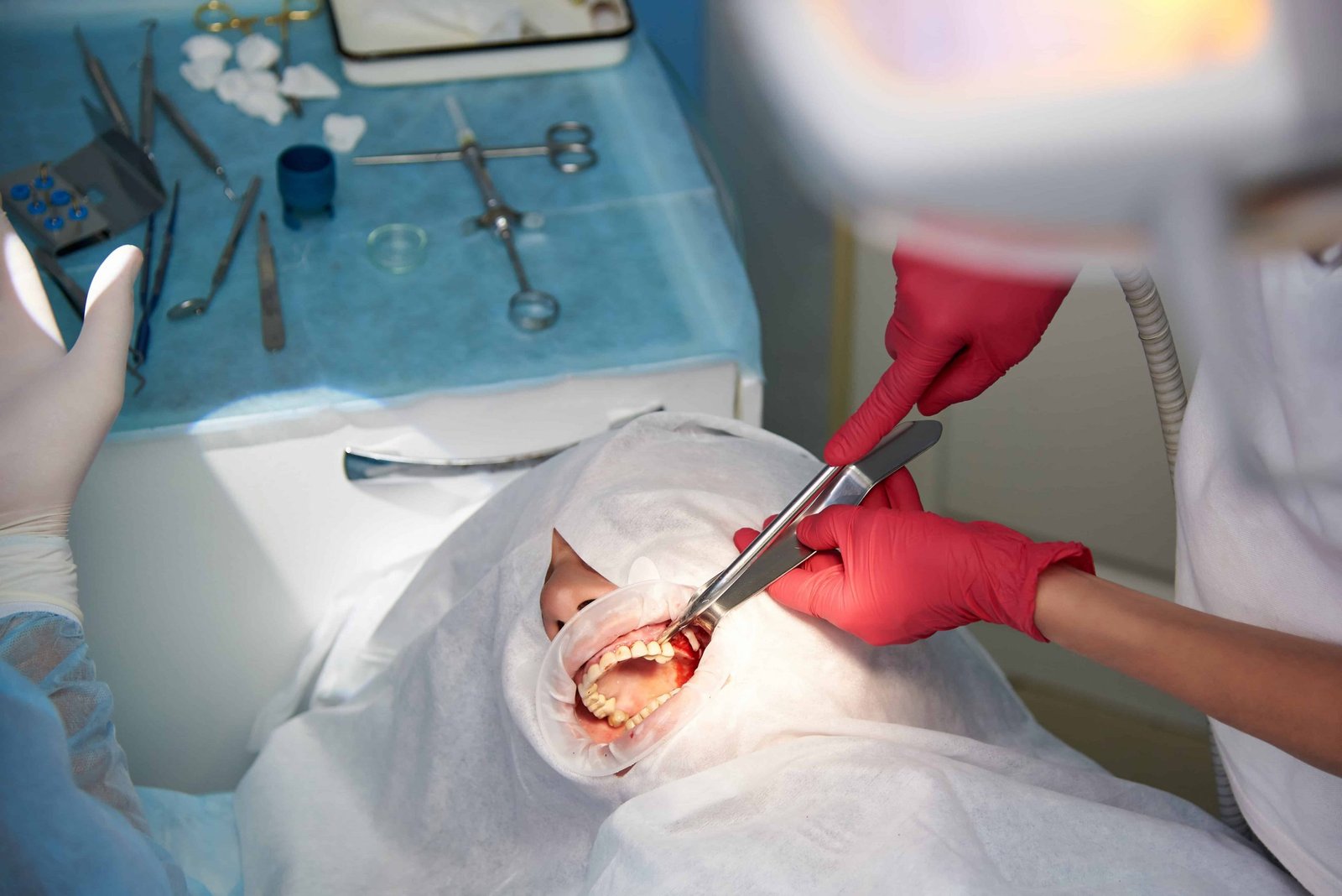surgery-in-a-dental-clinic-2021-09-02-02-46-55-utc (2)